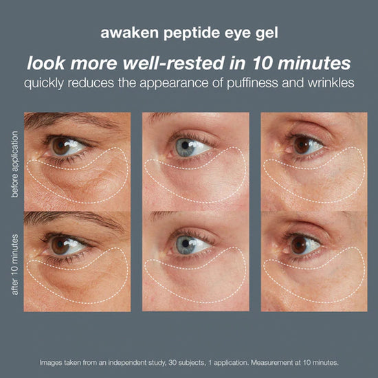 Dermalogica Awaken Peptide Eye Gel (15ml)